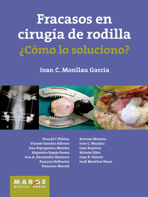cover image of Fracasos en cirugía de rodilla